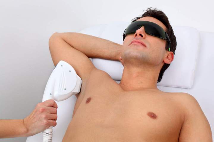 Epilation au laser homme Paris